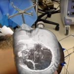 medical-software-maker-medivis-closes-2-3-million-funding-bring-hololens-surgical-platform.1280×600