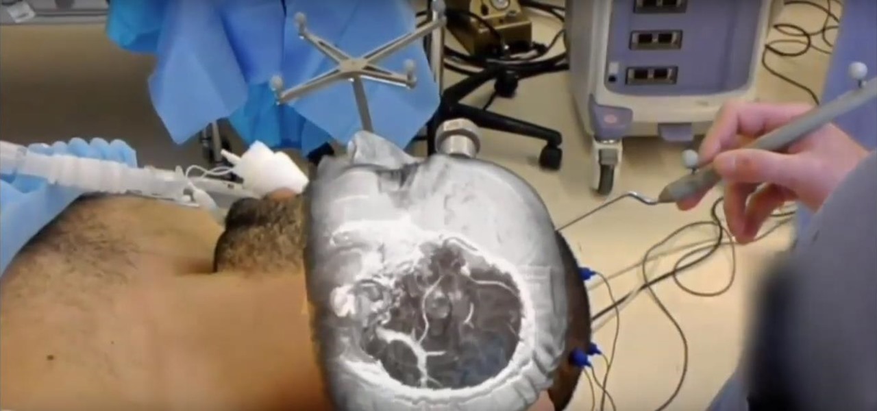 medical-software-maker-medivis-closes-2-3-million-funding-bring-hololens-surgical-platform.1280×600